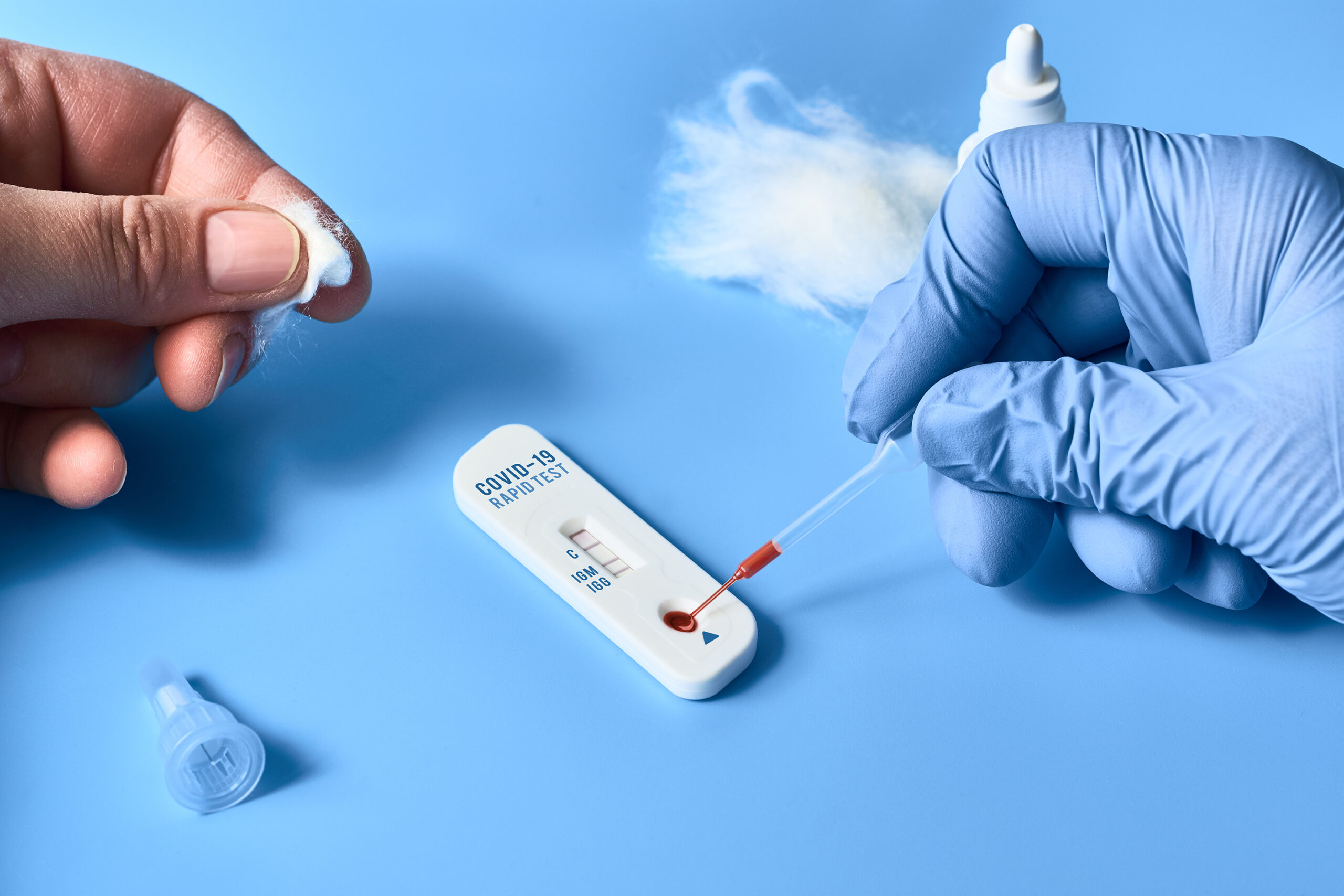 ข้อแตกต่างระหว่าง Rapid Antigen Test VS Rapid Antibody Test ตรวจโควิด ...